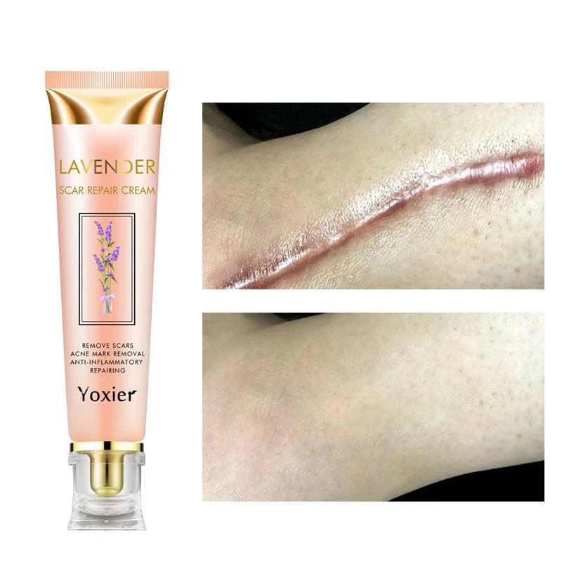 Yoxier Lavender Scar Repair Cream كريم إصلاح الندوب باللافندر