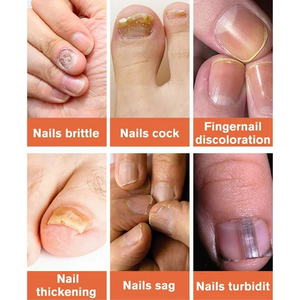 Nail repair essence سيروم إصلاح الأظافر