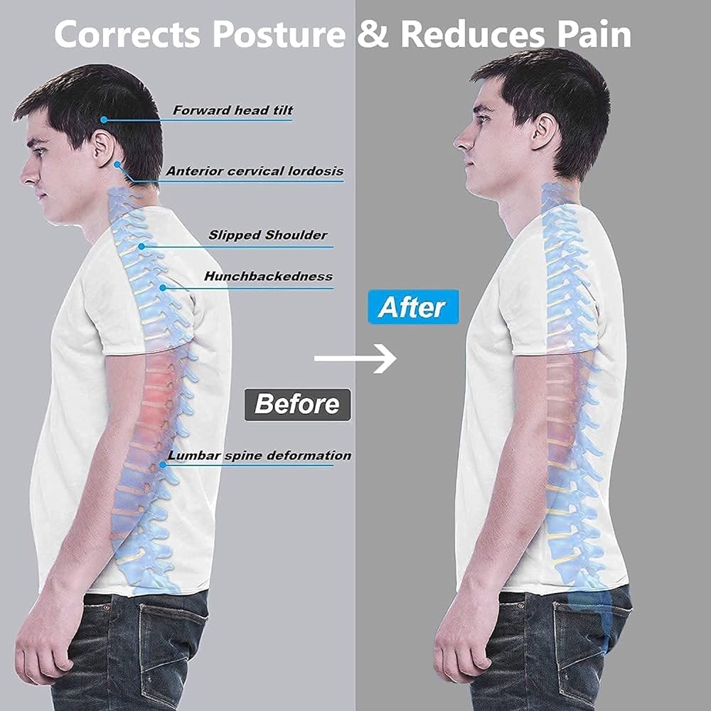 Back Smart Posture Corrector مقوّم ظهر ذكي