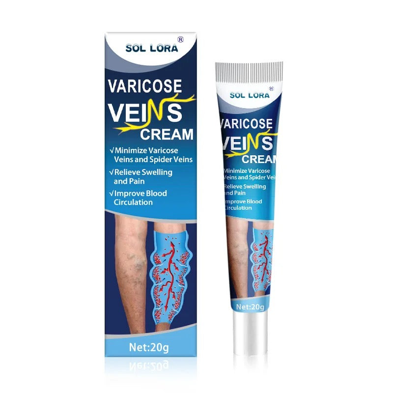 Varicose veins