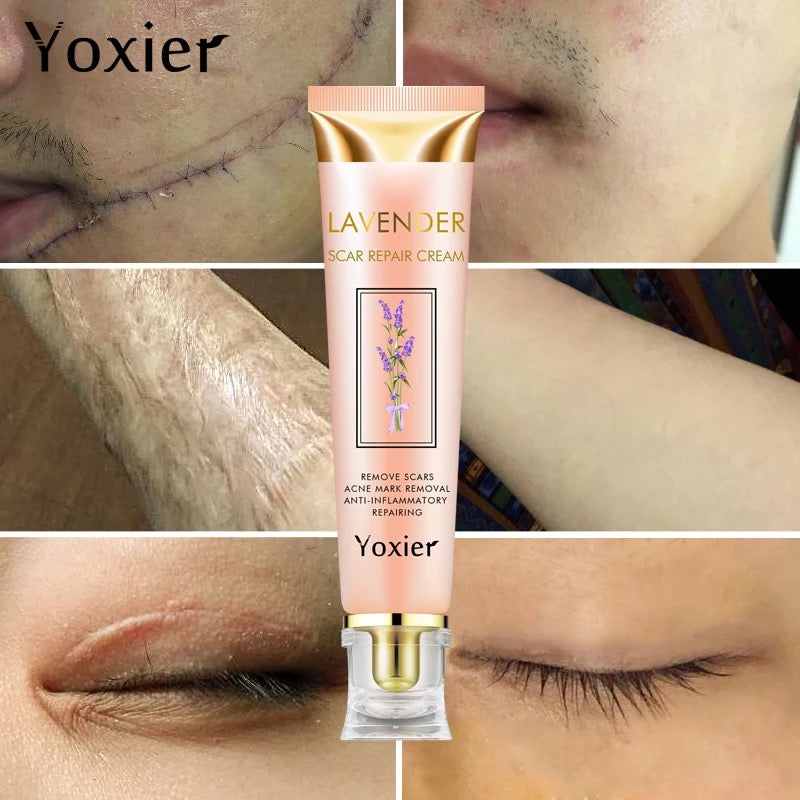 Yoxier Lavender Scar Repair Cream كريم إصلاح الندوب باللافندر