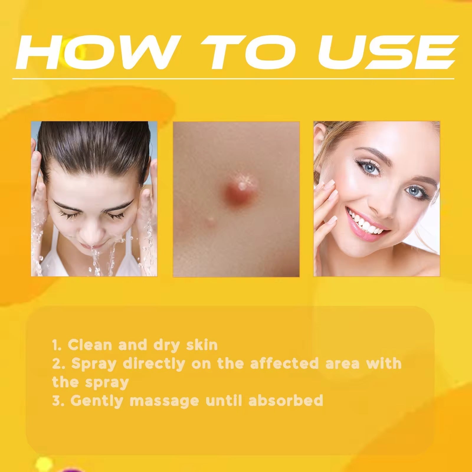 Skin Tag & Mole Remover Spray رشاش إزالة الزوائد الجلدية والشامات
