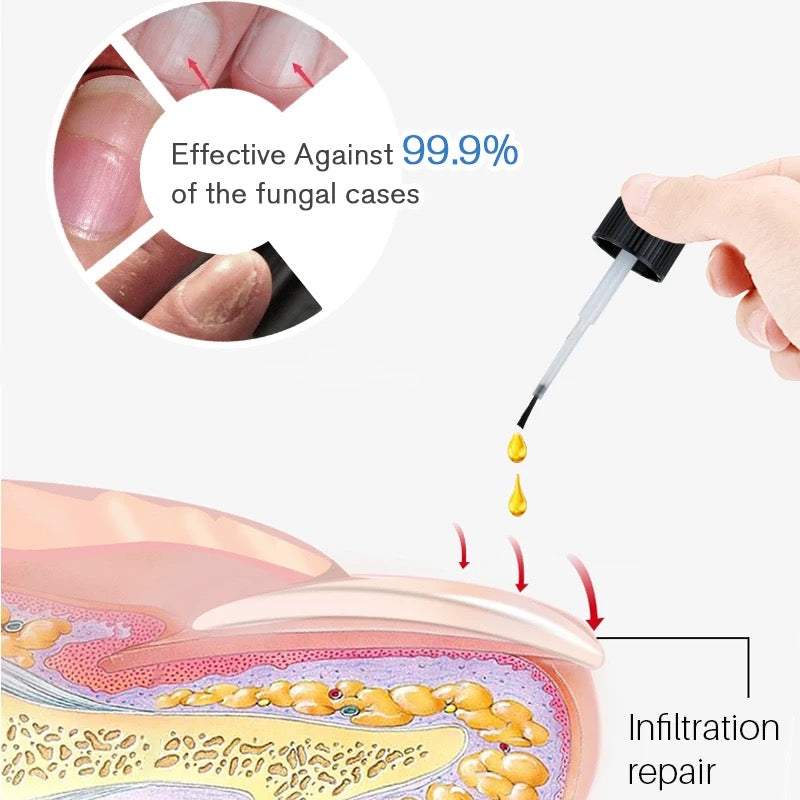 Nail repair essence سيروم إصلاح الأظافر