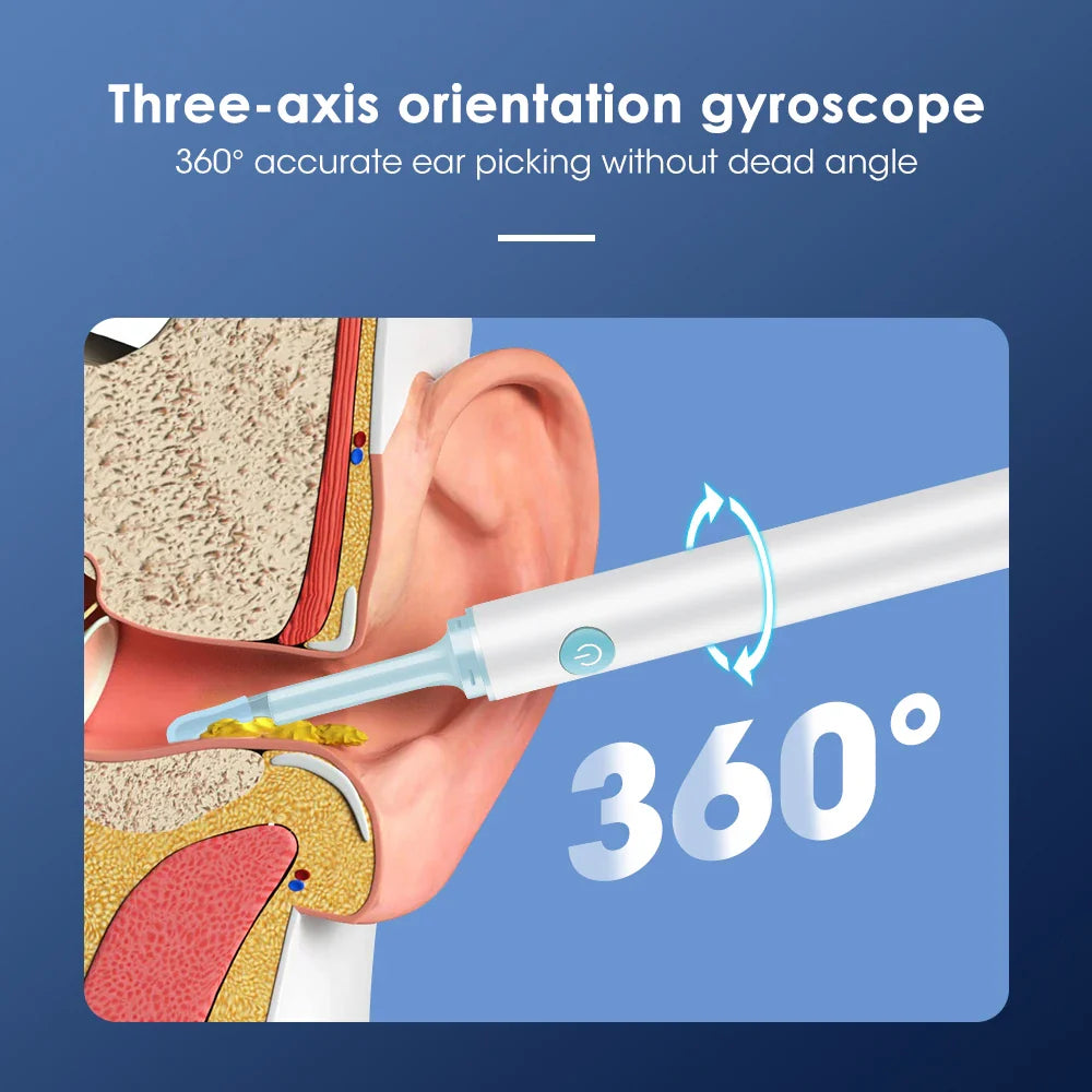 Intelligent Ear Wax Cleaner with 500MP Camera منظف أذن ذكي بكاميرا 500 ميغابكسل