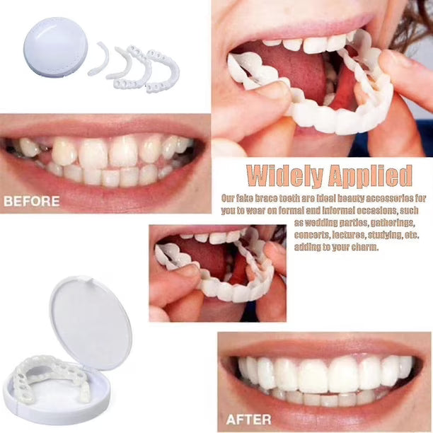 Snap on Smile ابتسامة هوليود المتحركة