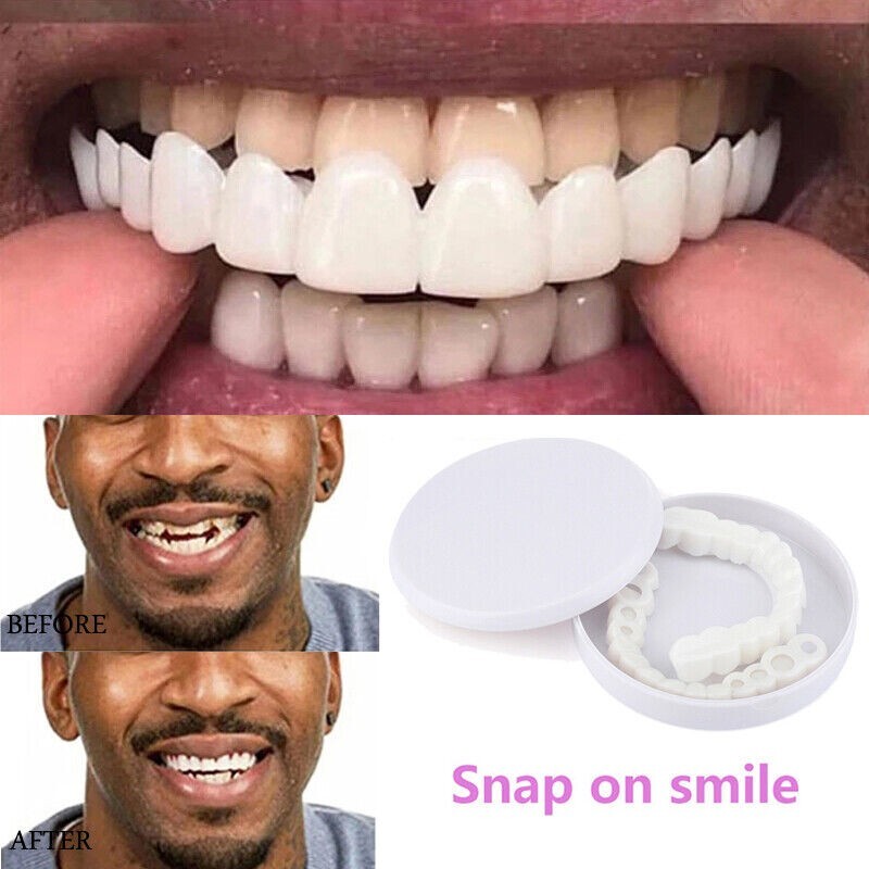 Snap on Smile ابتسامة هوليود المتحركة