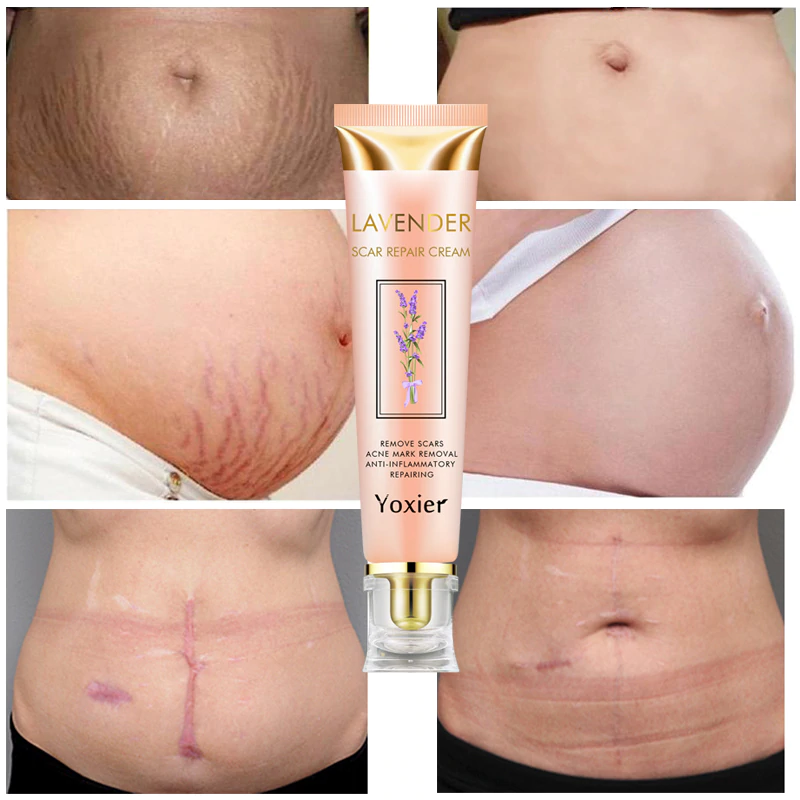 Yoxier Lavender Scar Repair Cream كريم إصلاح الندوب باللافندر